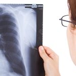 Doctor_viewing_xray_1200x675