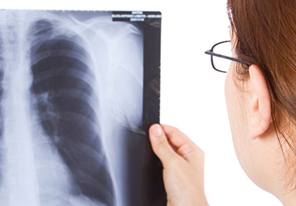 Doctor_viewing_xray_1200x675
